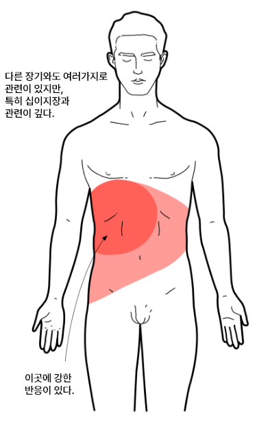 간암온열법01