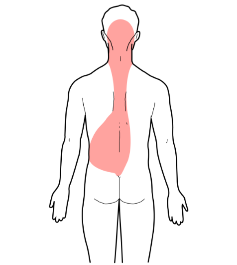 식도암온열법02